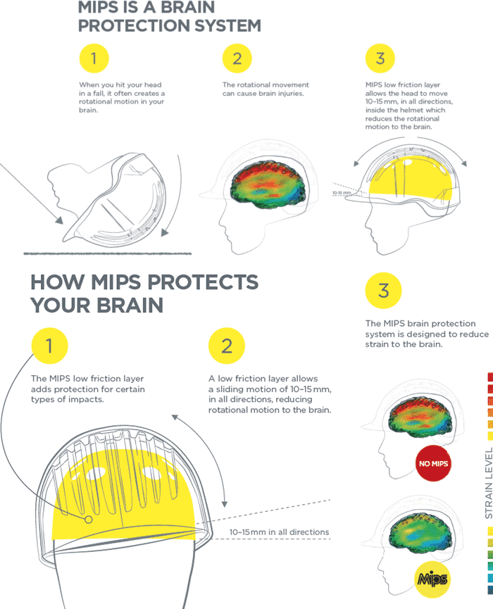 mips is a brain protection system